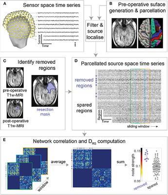 Removal of Interictal MEG-Derived Network Hubs Is Associated With Postoperative Seizure Freedom